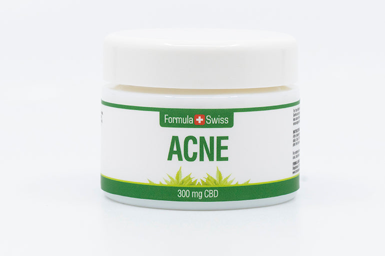CBD Acne
